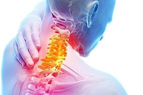 Príznaky krčnej osteochondrózy a pravidiel výživy pre choroby