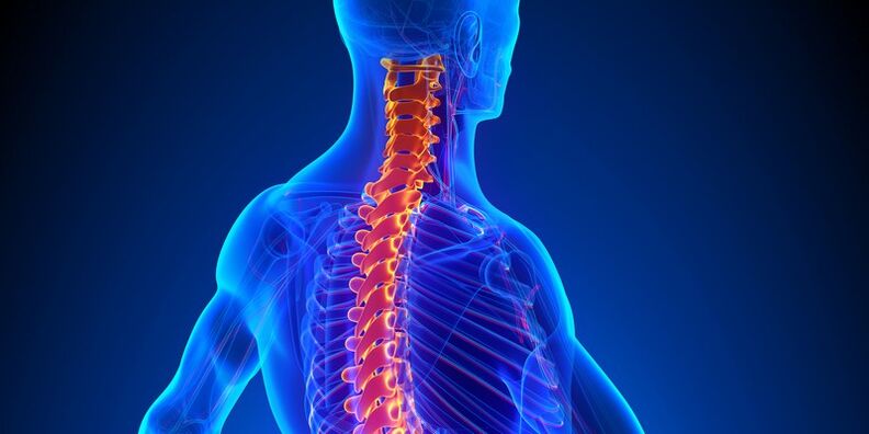 Cervikálna osteochondróza je jednou z najnebezpečnejších chorôb chrbtice