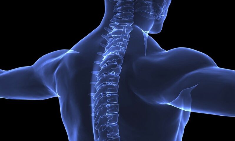Osteochondróza krčnej chrbtice môže vyvolať vegetatívnu vaskulárnu dystóniu