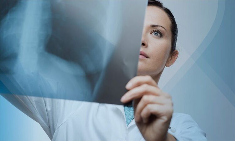 lekár skúma snímku krčnej chrbtice s osteochondrózou