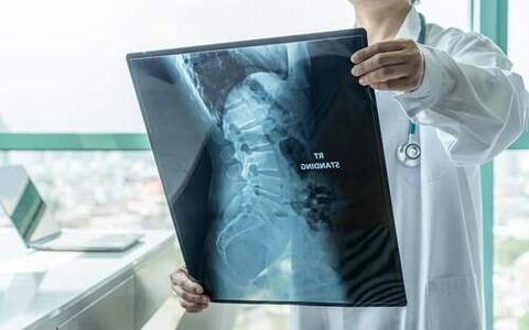 Röntgen je nevyhnutnou diagnostickou metódou, ak chrbát bolí